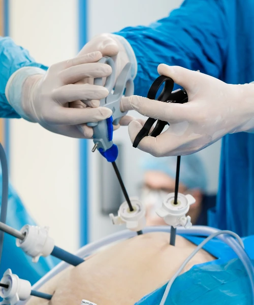 laparoscopic surgeries - faq