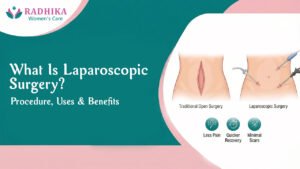 What Is Laparoscopic Surgery? Procedure, Uses & Benefits