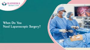 When Do You Need Laparoscopic Surgery?